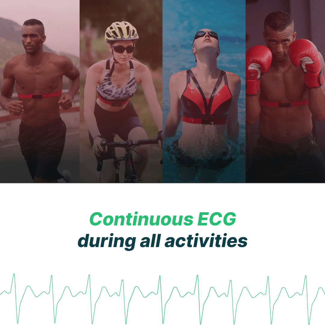 Frontier X Heart Rate Monitor Review 24 hrs Continuous ECG | Heart Rate Monitor Chest Strap | Frontier X