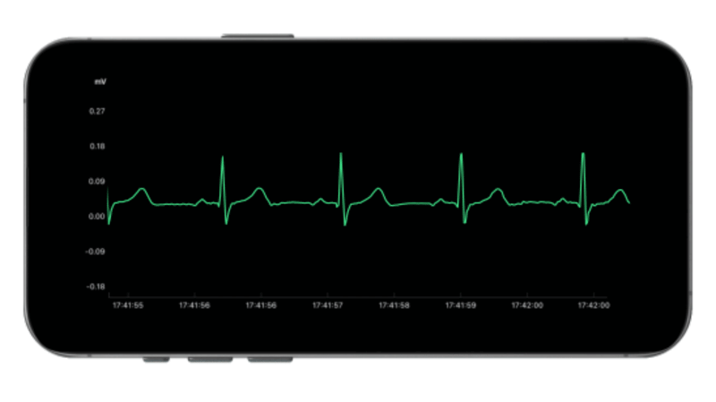 High Quality Continuous ECG