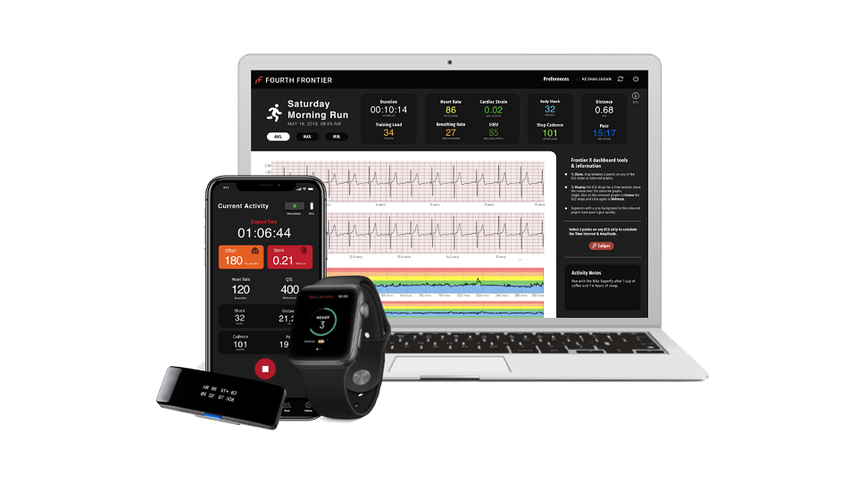 Frontier Heart Program | One-Time ECG Review